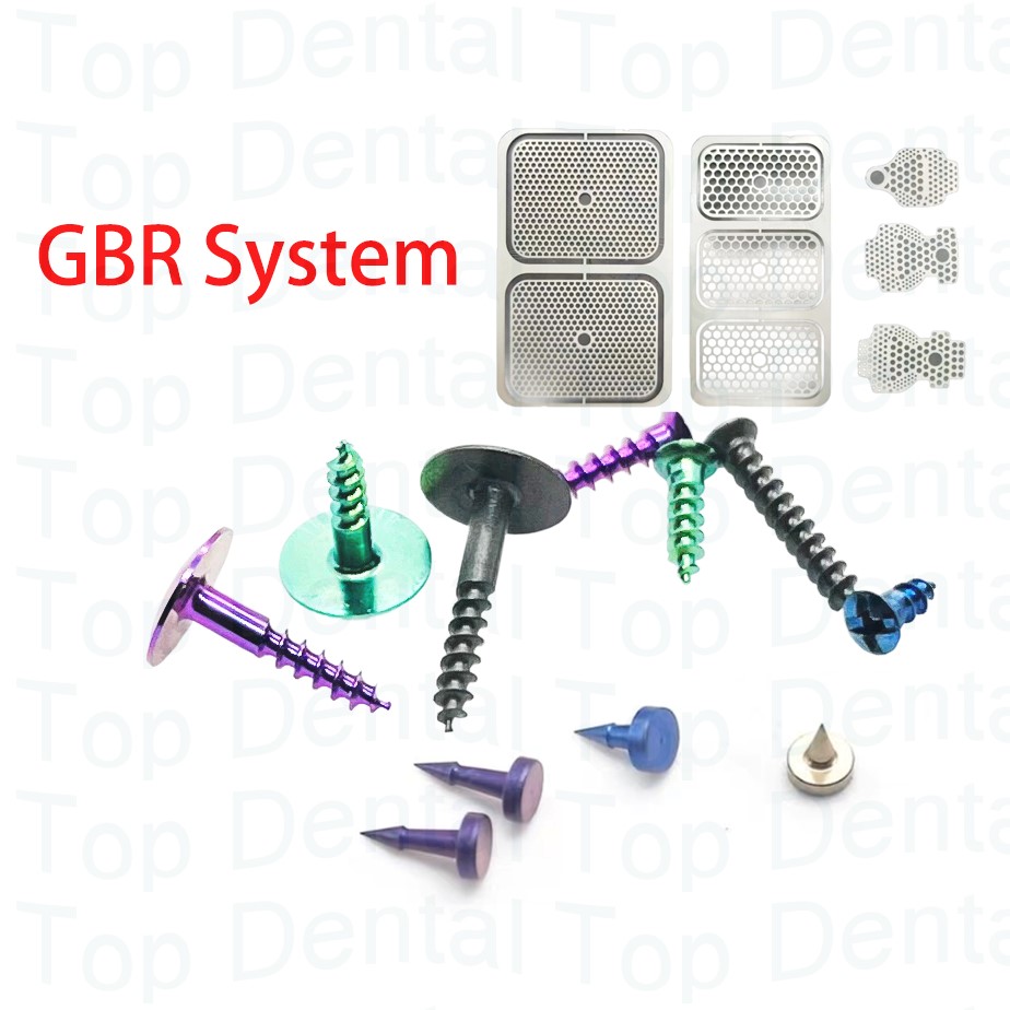 Stabilizer Screw In - 10 шт., стоматологическая система GBR, костные