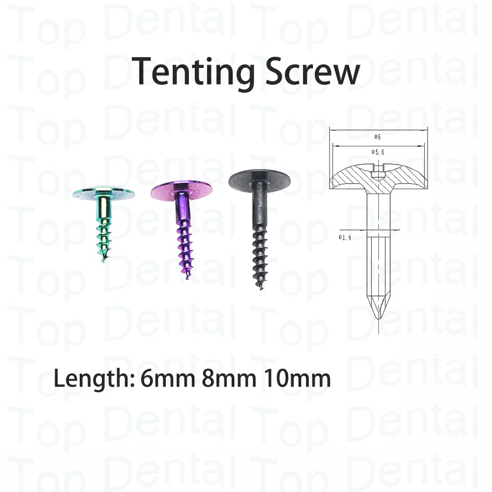 10 шт., стоматологическая сист – обзор и цена Stabilizer Screw In