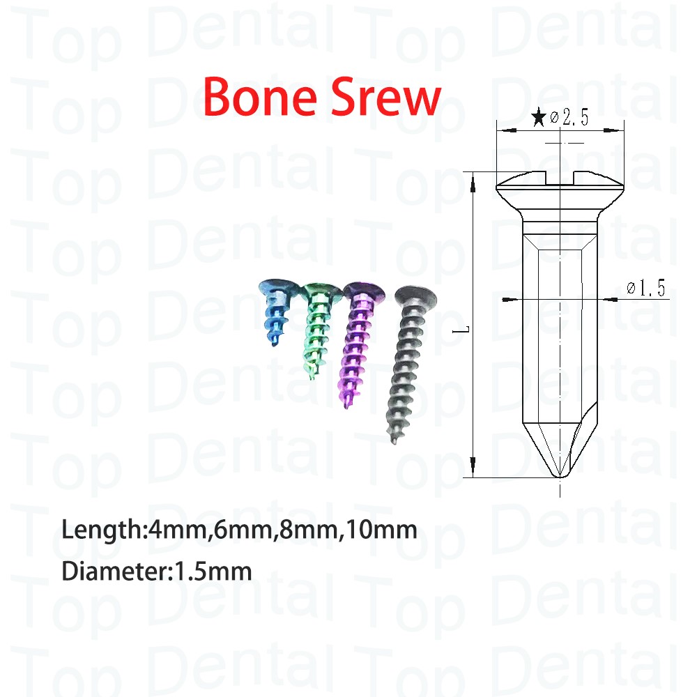 10 шт., стоматологическая сист – обзор и цена Stabilizer Screw In